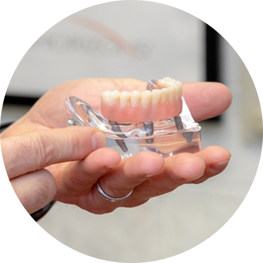 dental-implants-mode